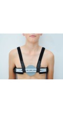 9511-PECTUS CARINATUM